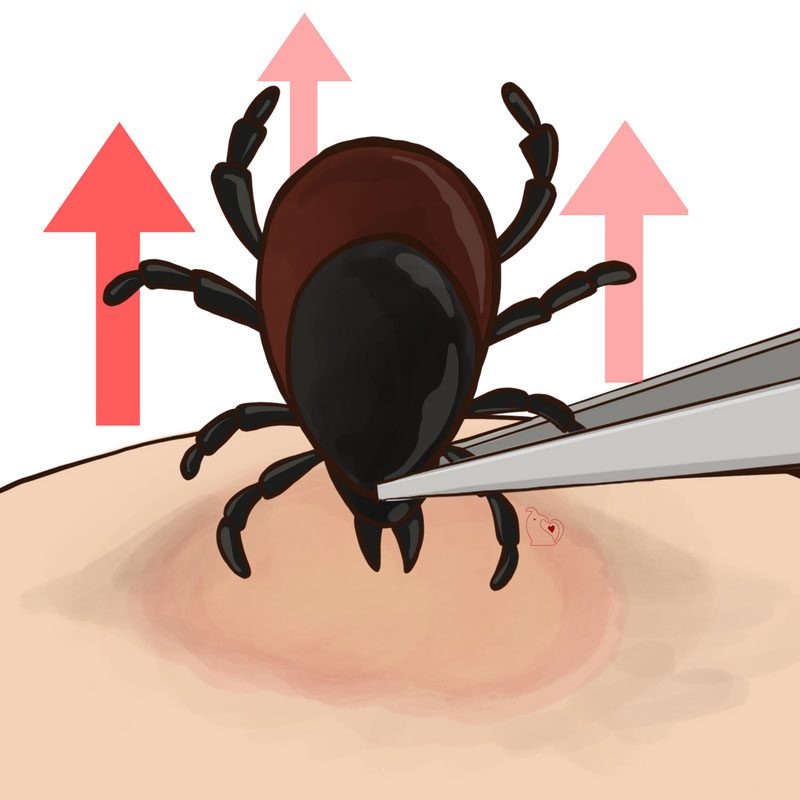 the proper way on how to remove a tick on dogs